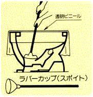 イラスト：ラバーカップ（スポイト）と透明ビニールを使ったつまり対応